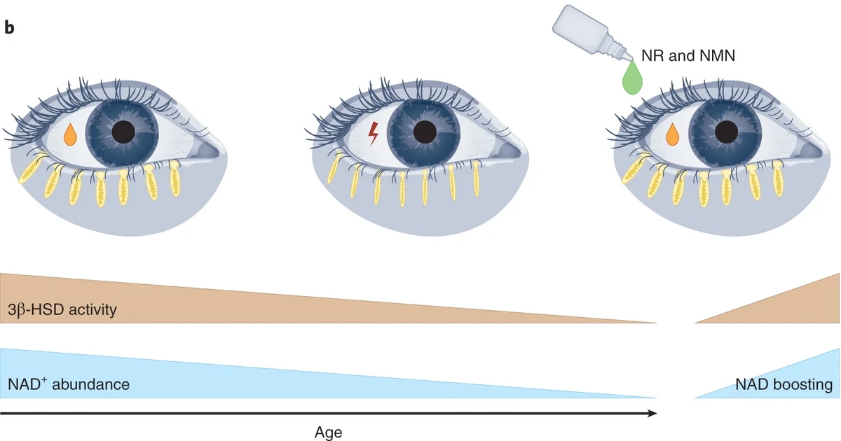 【科技进展】NAD+促进剂滴眼液治疗与年龄有关的干眼症