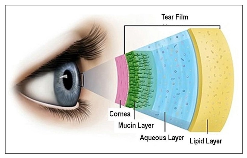 What is Dry Eye?